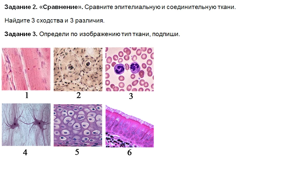 Задание 2. «Сравнение». Сравните эпителиальную и соединительную ткани.